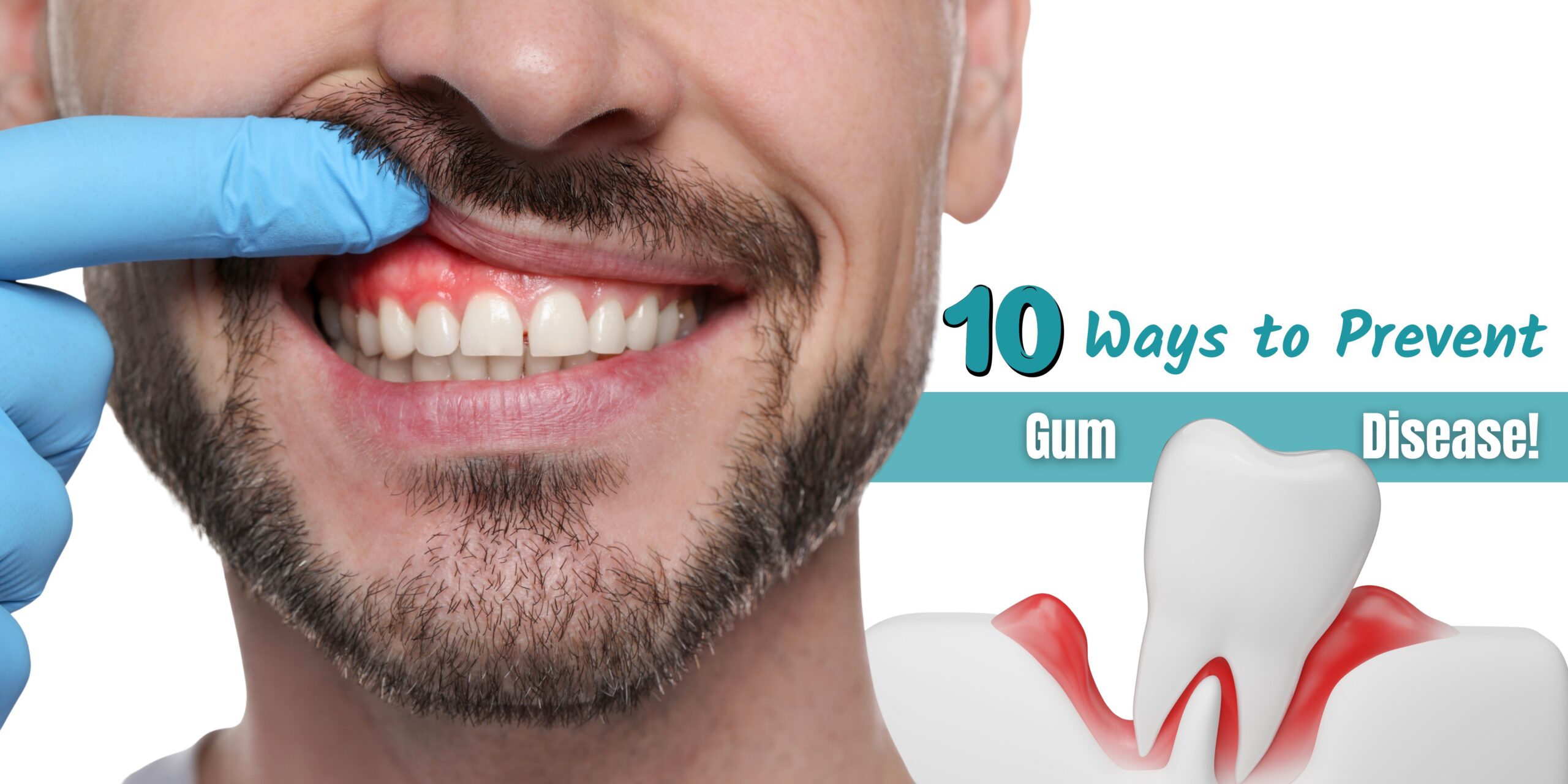 How to Prevent Gum Disease | 10 Proven Tips for Healthy Gums