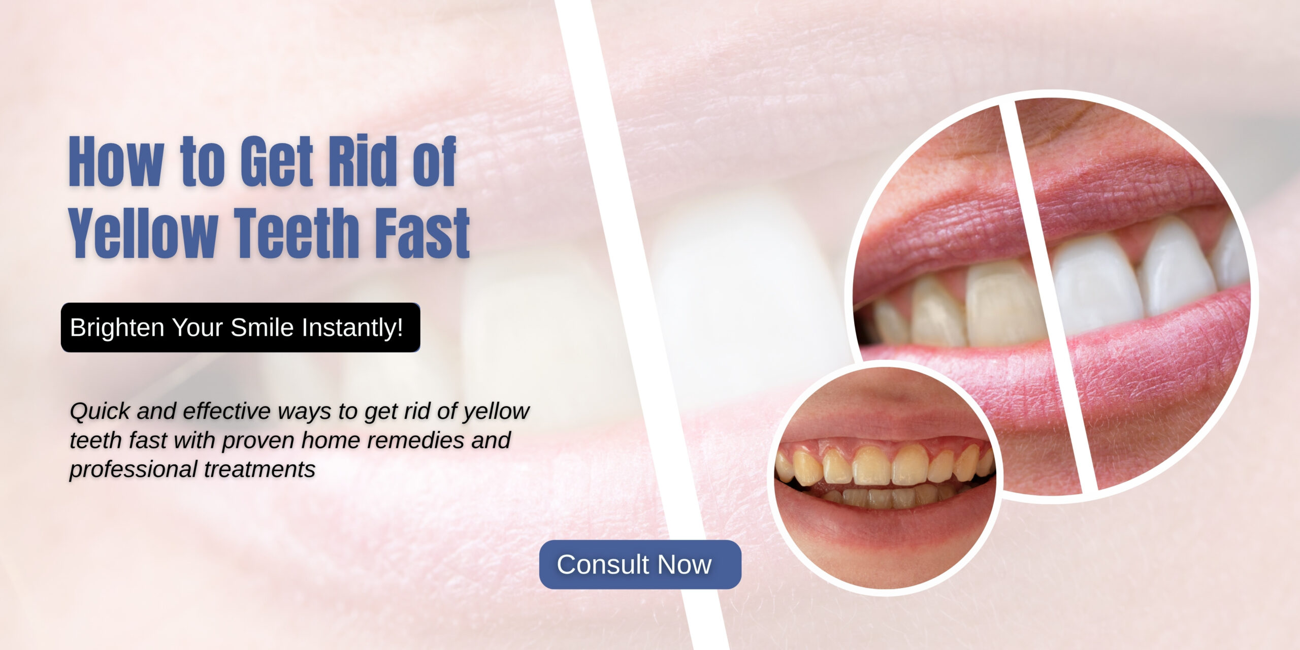 How to Get Rid of Yellow Teeth Fast | Expert Whitening Tips & Care