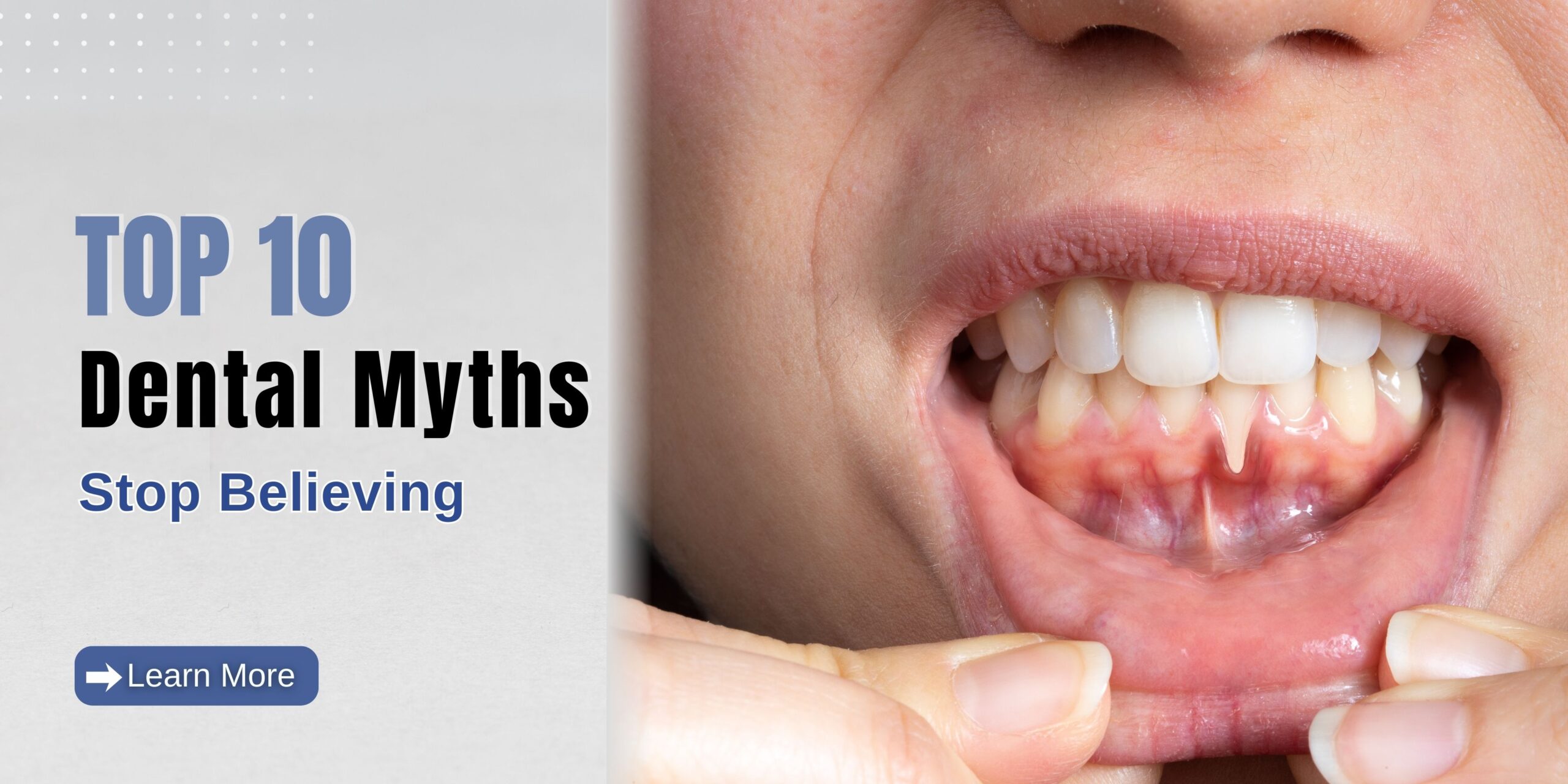 Top 10 Dental Myths to Stop Believing | Dr. Saket