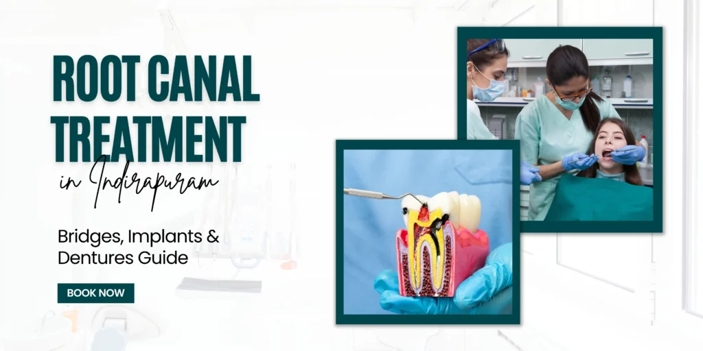 missing-tooth-treatment-implants-bridges-dentures-root-canal-treatment-in-indirapuram