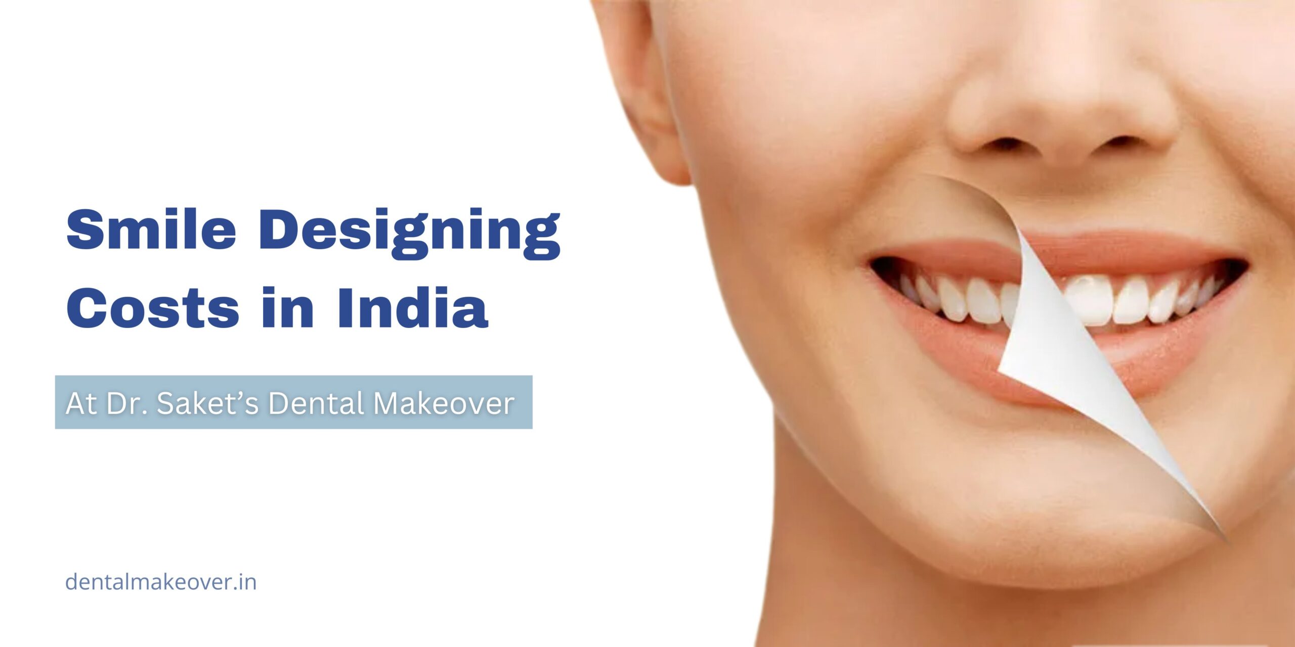 What Affects Smile Designing Costs in India? Expert Price Insights