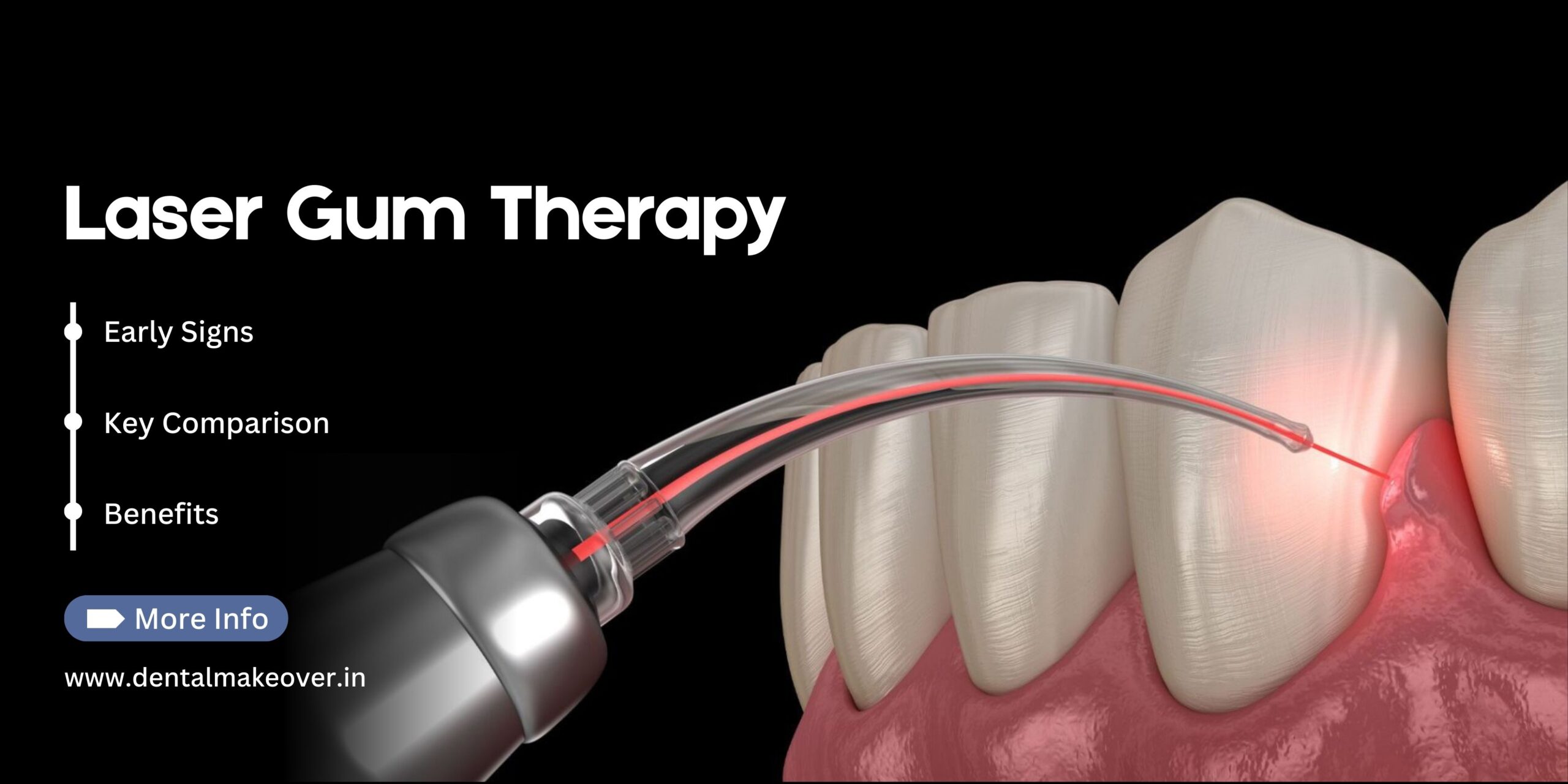 Precision Laser Gum Therapy in Ghaziabad for Safe, Painless Results