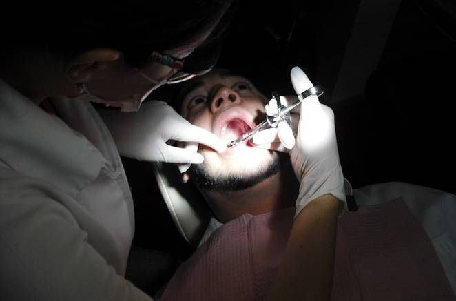 professional-treatment-teeth-sensitivity-fluoride-filling-ghaziabad